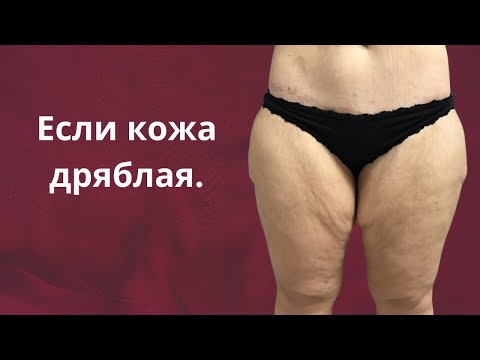 Как ПОДТЯНУТЬ дряблую кожу и уменьшить целлюлит в зрелом возрасте.