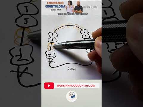 🦷 Classificação de Kennedy na prática!