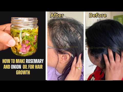 Diy ROSEMARY And ONION HAIR OIL Recipe For Faster Hair Growth And Stop Hair Fall 🌿🧅