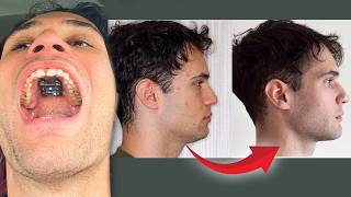 Looksmaxxer splits skull in half to look better | Interview w @AsherLite2000