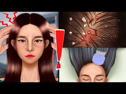 ASMR Very Satisfying Scalp Scaling Care Animation‼️, Makeup, Blackhead, Brainrot