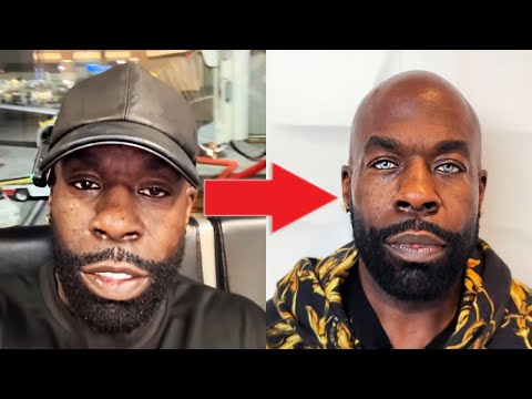 Kali Muscle Undergoes Extreme Procedure to Permanently Change His Eye Color