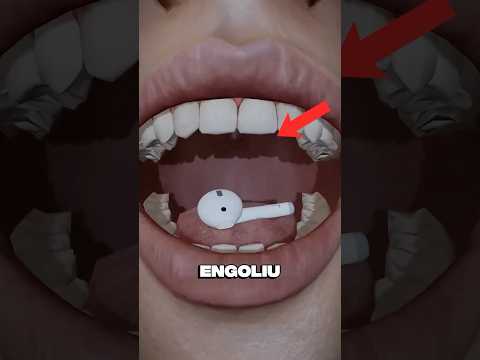 ELE ENGOLIU UM FONE DE OUVIDO! 🎧 #curiosidades #shorts #fy #yt #fone #engoliu #memes