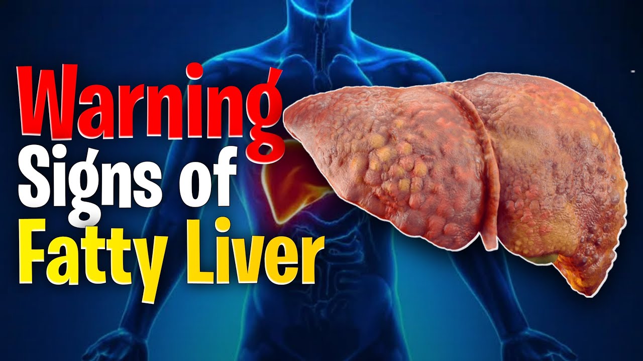 Don’t Ignore These Warning Signs of Fatty Liver