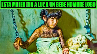 Esta mujer dio a luz a un bebé hombre lobo