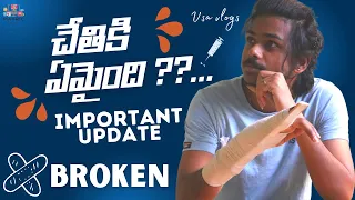 WHAT HAPPENED TO MY HAND ??@VSAVLOGS YOUR QUESTIONS ANSWERED...#telugu #teluguvlogs #vsavlogs #duke