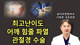 어깨 회전근개파열 상부관절막 재건술 [날아라정형외과 어깨특화 수술센터]