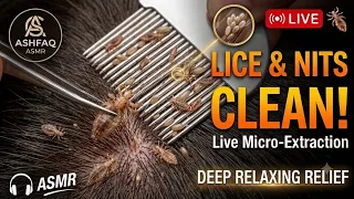 LICE CLEAN LIVE 🔴🪳