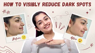 HOW TO VISIBLY REDUCE DARK SPOTS | GLYCOLIC BRIGHT RANGE || AMULYA RATTAN