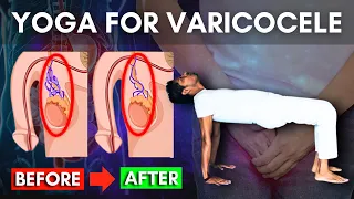 Yoga for Varicocele Relief | Part 1 Home Routine for Testicular Health #varicocele