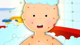 Caillou et les Éruptions Cutanées | Caillou en Français
