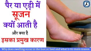 पैर या एड़ी में सूजन क्यों होती है और इसका मुख्य कारण, common causes for foot or heel swelling