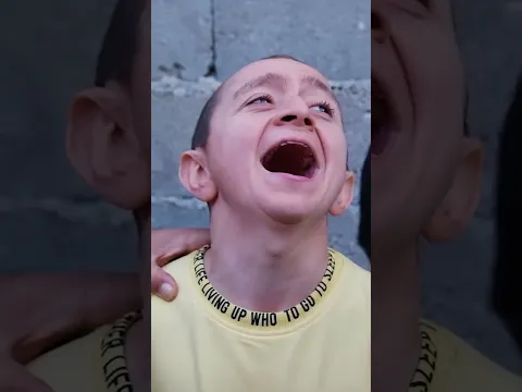 Sünnet oldum