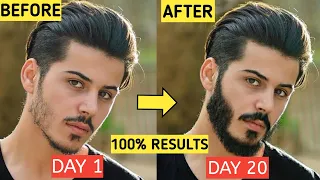 5 ULTIMATE BEARD Growth Hacks For Teenagers At Home *100% RESULTS* | Patchy Beard Solution In Hindi