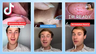 The Best TikTok Blackhead Removal Reactions Compilation!