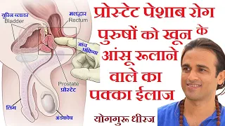 Prostate Enlarged प्रोस्टेट BPH Urine पेशाब रोग ईलाज Pelvic Muscle Yogasan exercise Yogguru Dheeraj