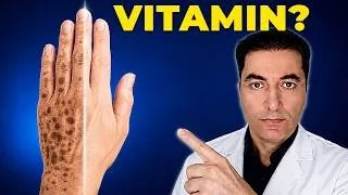 Vitamin broj 1 za uklanjanje staračkih pjega nakon 50. godine