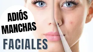 UN MILLÓN DE VECES MÁS EFICAZ que el BOTOX | ELIMINA ARRUGAS Y MANCHAS de FORMA NATURAL y CASERA