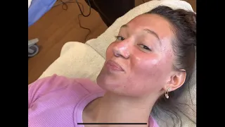 Getting the VAMPIRE FACIAL!!!
