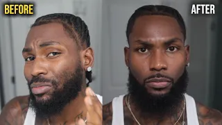 Patchy Beard to Full Beard in 15 Minutes