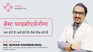 ब्रैस्ट फाइब्रोएडेनोमा (breast fibroadenoma)  क्या होते हैं?  - Dr. Rohan Khandelwal  Breast Surgeon