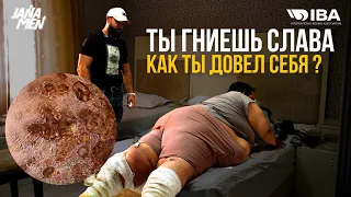 НОГА ЗАЖИВАЕТ ИЛИ ГНИЕТ ? | ИГОРЬ ПОСЛЕ ОПЕРАЦИИ | 