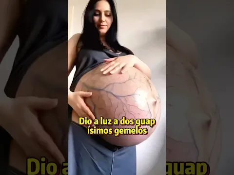 Dio a luz a dos guapísimos gemelos