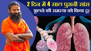 2 दिन में 4 साल पुरानी सांस फूलने की समस्या को किया दूर || Swami Ramdev