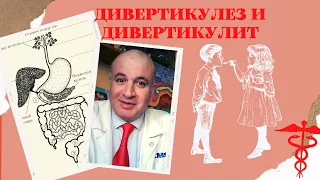 Дивертикулез и Дивертикулит: Симптомы, лечение и профилактика