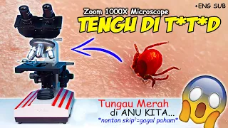 INILAH TUNGAU MERAH YG SUKA GIGIT tytyd KITA | Red Mites Microscope Zoom 1000X