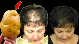 O cabelo cresce loucamente e não cai! Esta é a receita mais poderosa! (Sabia disso?)