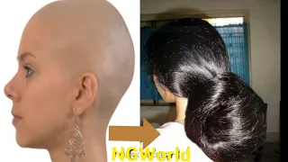 Apply Before Sleep, Fastest Hair Growth Overnight, Grow Long and Thicken Hair  ll NGworld