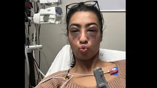 Life Threatening Allergic Reaction Vlog