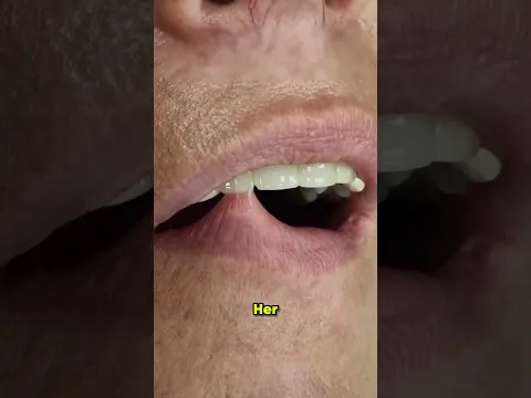 Dont pull it 😨