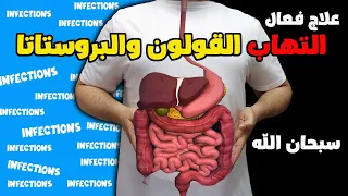 علاج سريع لالتهابات القولون والبروستاتا والامعاء