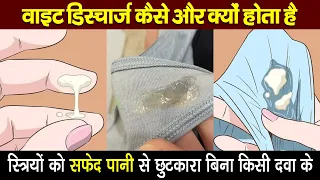 स्त्रियों को सफेद पानी से छुटकारा बिना किसी दवा के ! कैसे करे Vaginal Discharge को नार्मल?