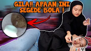 #INDIRABUKAPRAKTEK KEMBALI BERAKSI - KALIAN GA AKAN NYANGKA ADA APA DIDALEM KUPING INI !!