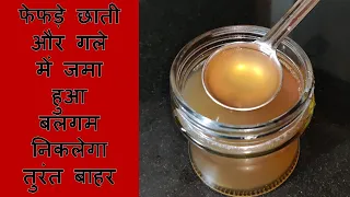 बस 2 चम्मच पीलें फेफड़े छाती गले में सालों से जमा हुआ कफ बलगम तुरंत बाहर - दोबारा कभी नहीं होगा