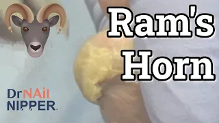 Best Ram's Horn Toenails ALL YEAR. How to cut rams horn toenails? FEET-ure Friday (2022)