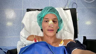 Ecco come mi ha rotto il naso...