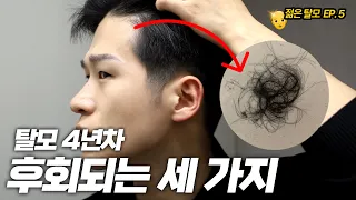 내 탈모를 더 심하게 만든 3가지 실수들😔 젊은탈모 최종화