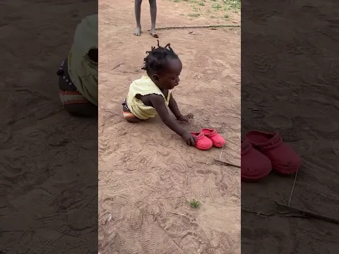 Having no Legs 🦵 but when you Crying 😢 for the Shoes 👞
