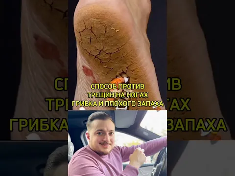 Против трещин, грибка и плохого запаха на ногах ✅