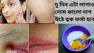 দু দিন এটা লাগাও মুখের লোম কালো দাগ উঠে যাবে ত্বক ফর্সা কাঁচের মত ঝকঝকে হবে/Facial hair remove/Glow