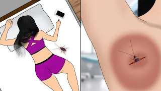 ASMR Remove Cockroach from infected armpit animation