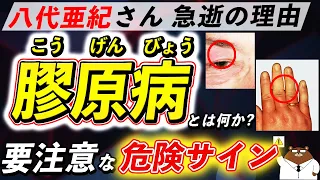 放置厳禁！知らないと後悔する「膠原病」が引き起こす体の変化。なぜ八代亜紀さんは急逝したのか。初期の危険サインとは？医師が徹底解説！