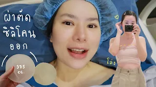 เอาซิลิโคนหน้าอกออกแล้ว