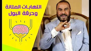 علاج مذهل لإلتهابات المسالك البولية والمثانة وحرقة البول