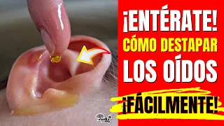 ¿OIDOS TAPADOS?👂Mira Como Destapar Los Oidos, Con estos 3 Remedios Caseros