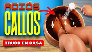 🔥 CON ESTO ELIMINE LOS CALLOS DELOS PIES o Dureza en los Pies